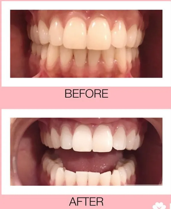 29141 whitening products
