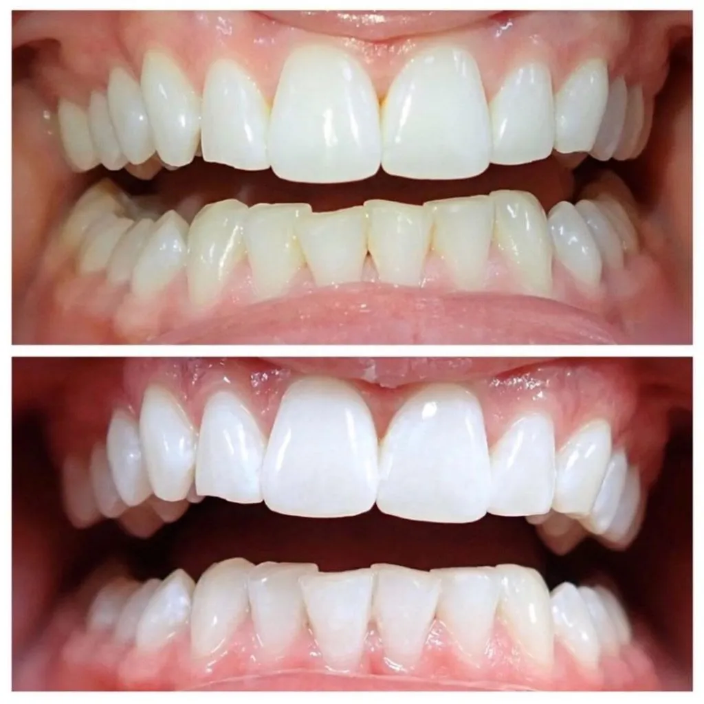 29142 confident smile