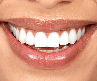 /img/29142-smile-maintenance.webp
