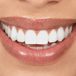 /img/29142-smile-maintenance.webp