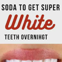/img/29145-professional-teeth-whitening.webp