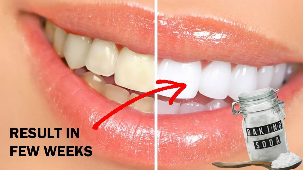 29145 teeth whitening guide