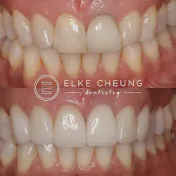 /img/29148-bright-smile-teeth-whitening.webp
