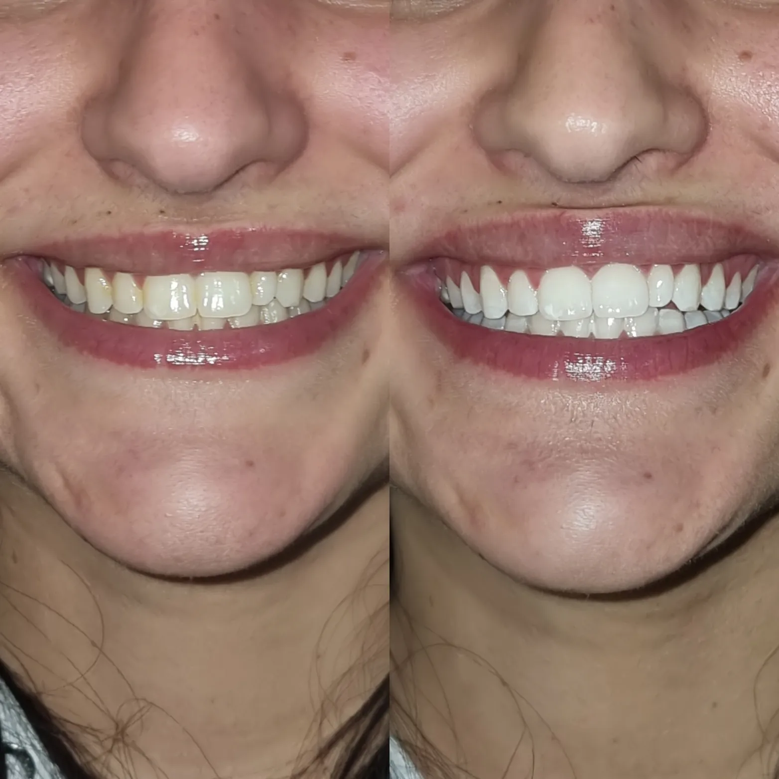 /img/29151-healthy-smile-tips.webp