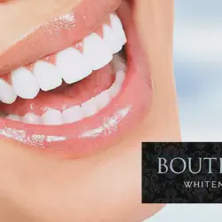 /img/29153-teeth-whitening-consultation.webp