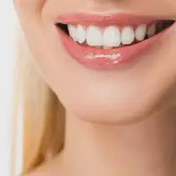 /img/29154-professional-teeth-whitening.webp