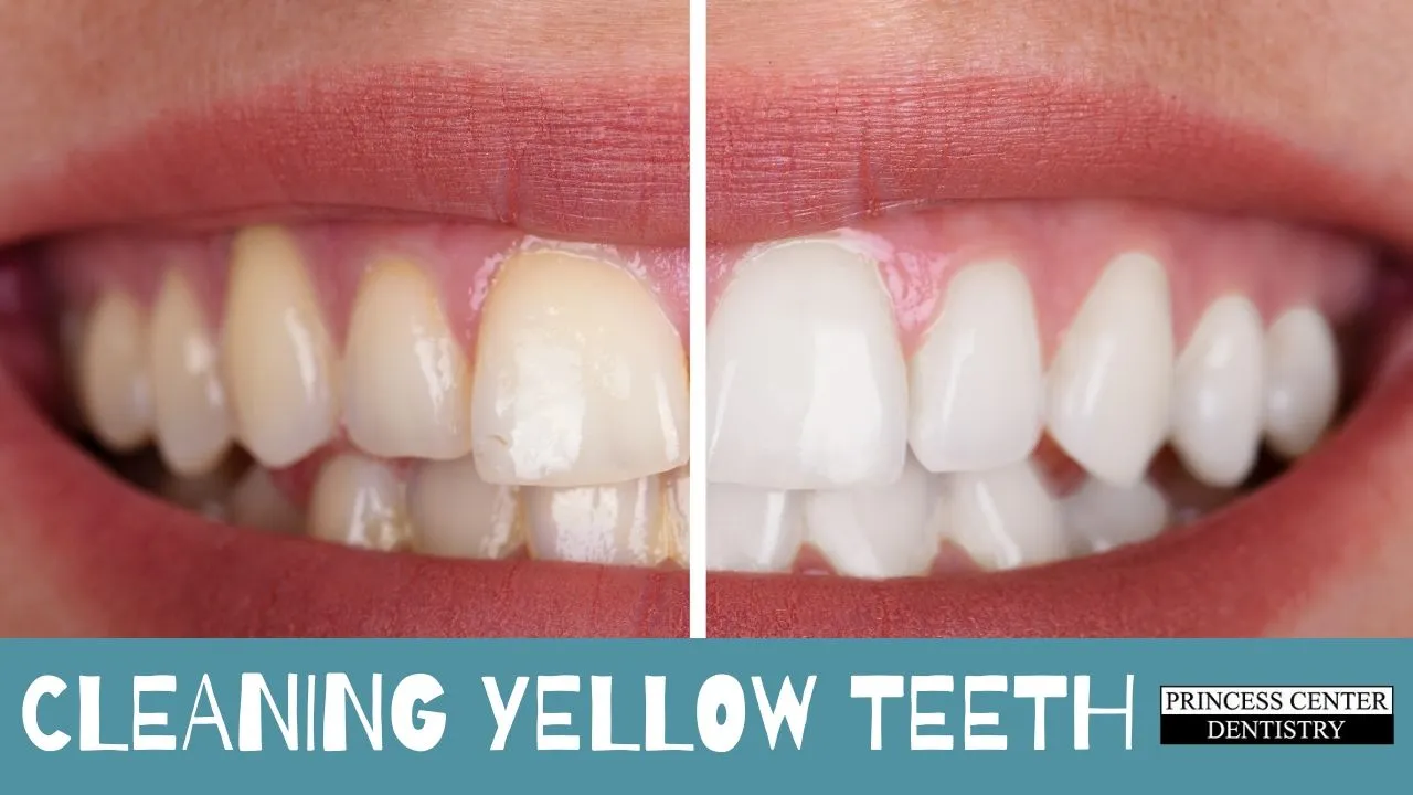 29155 sensitivity toothpaste