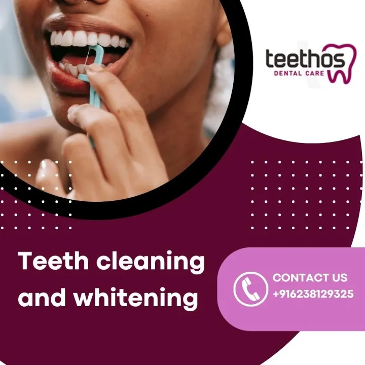 29155 teeth cleaning importance