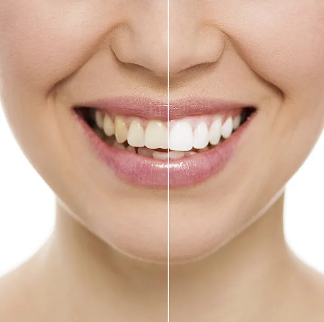 29156 bright smile maintenance