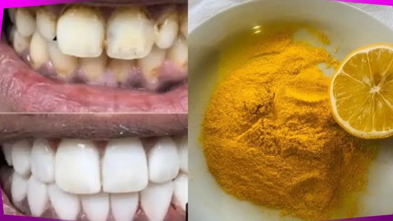 /img/29160-healthy-smile.webp