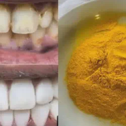 /img/29160-healthy-smile.webp