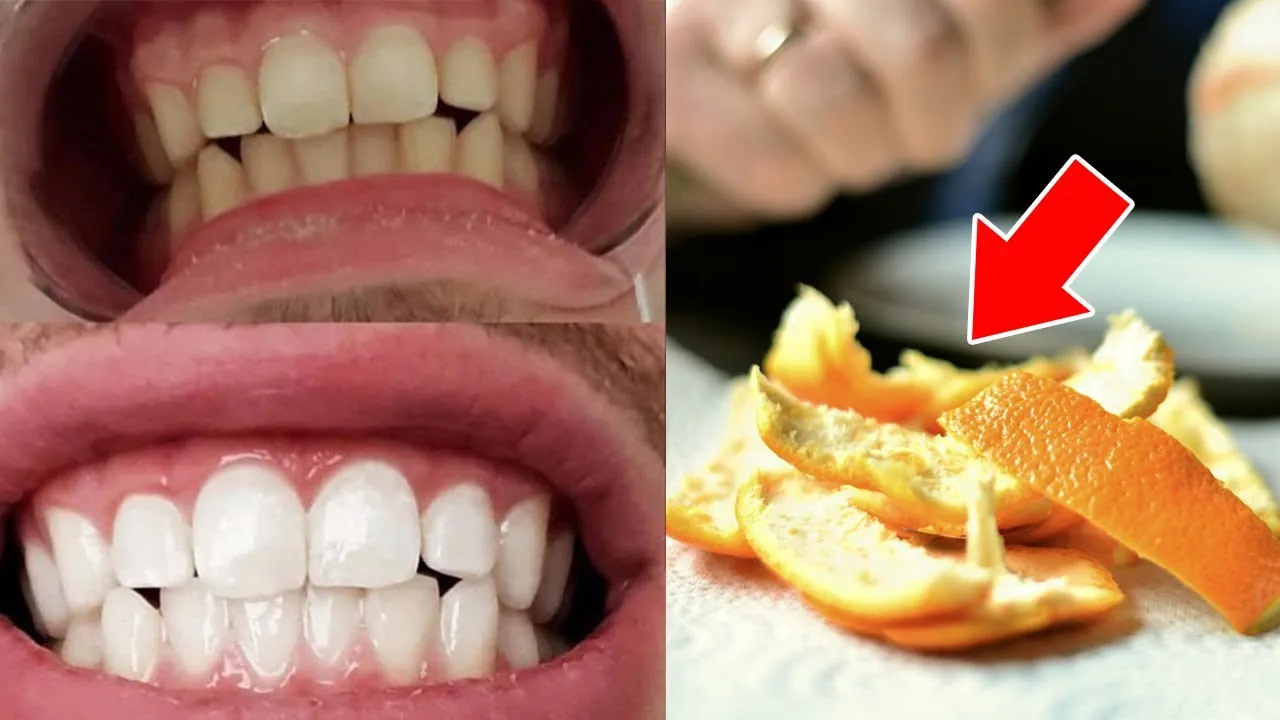 29160 orange peel science