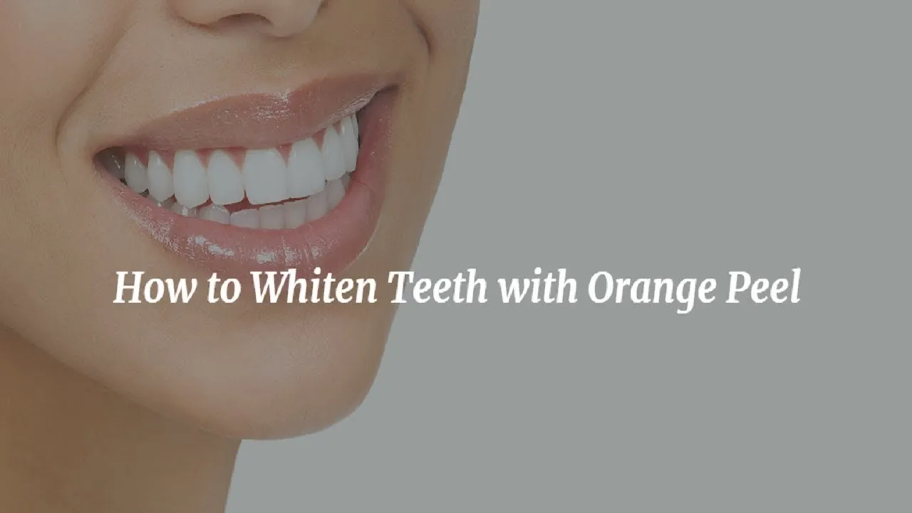 29160 teeth whitening aftercare