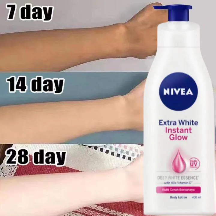 /img/29163-skin-allergy.webp