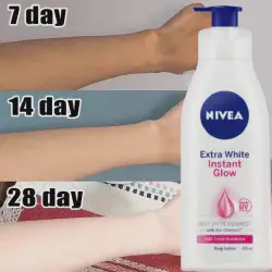 /img/29163-skin-allergy.webp