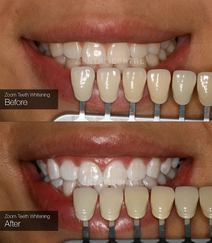 29165 confident smile