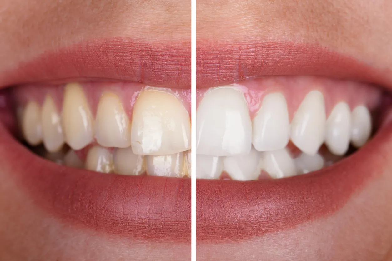 29165 polish dentist
