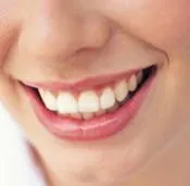 29165 teeth whitening cost