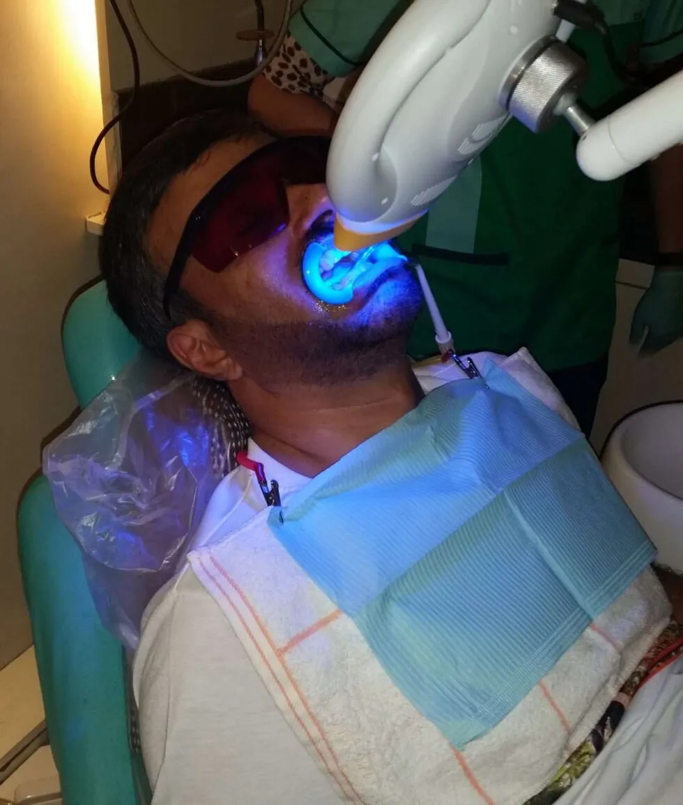 29167 professional teeth whitening