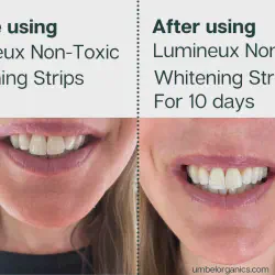 /img/29168-alternatives-whitening.webp