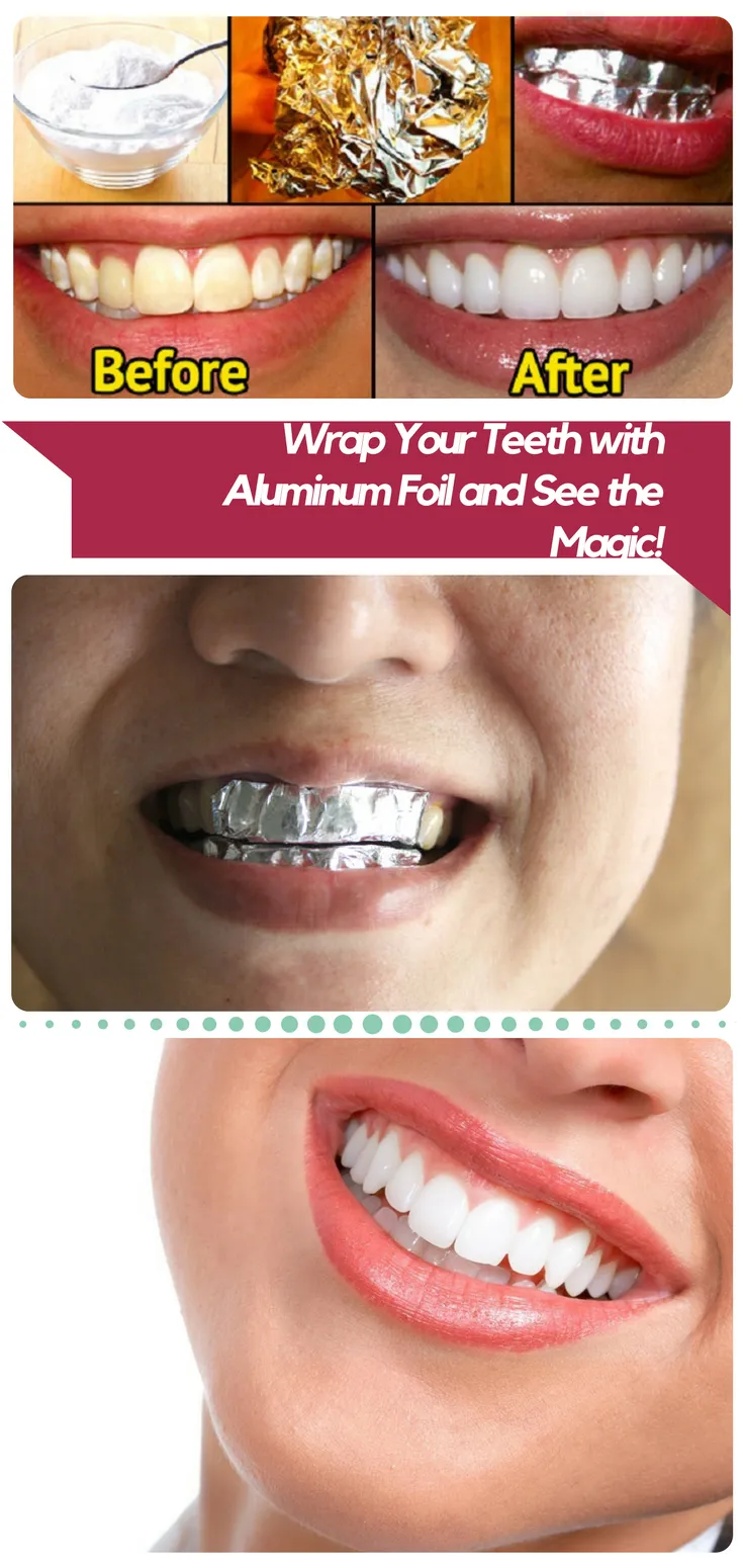 29171 aluminium teeth whitening products