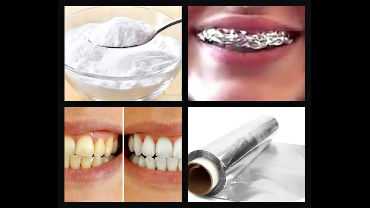 /img/29171-choosing-teeth-whitening-product.webp