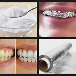 /img/29171-choosing-teeth-whitening-product.webp