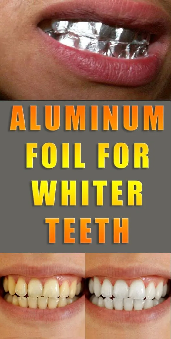 29171 comparing teeth whitening methods