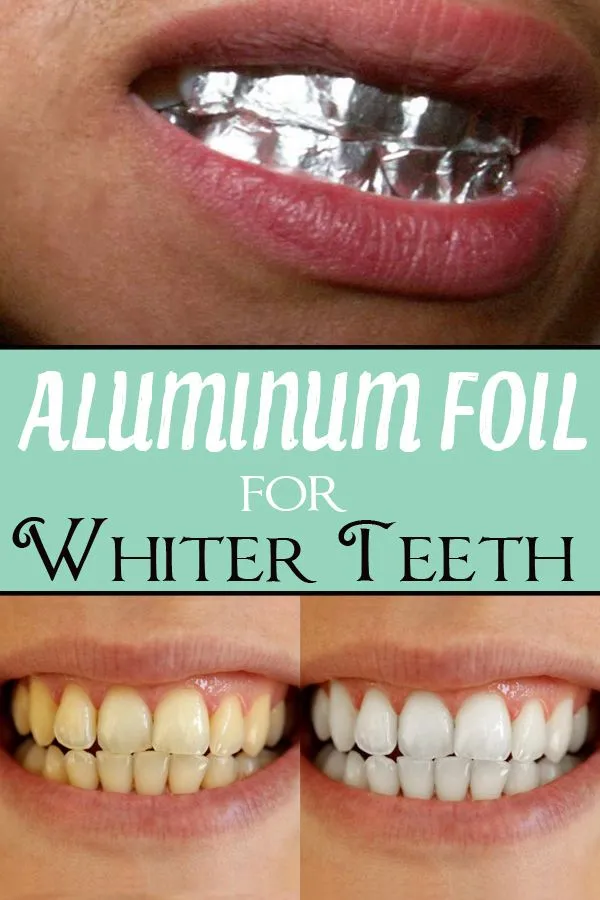 29171 healthy gums and teeth
