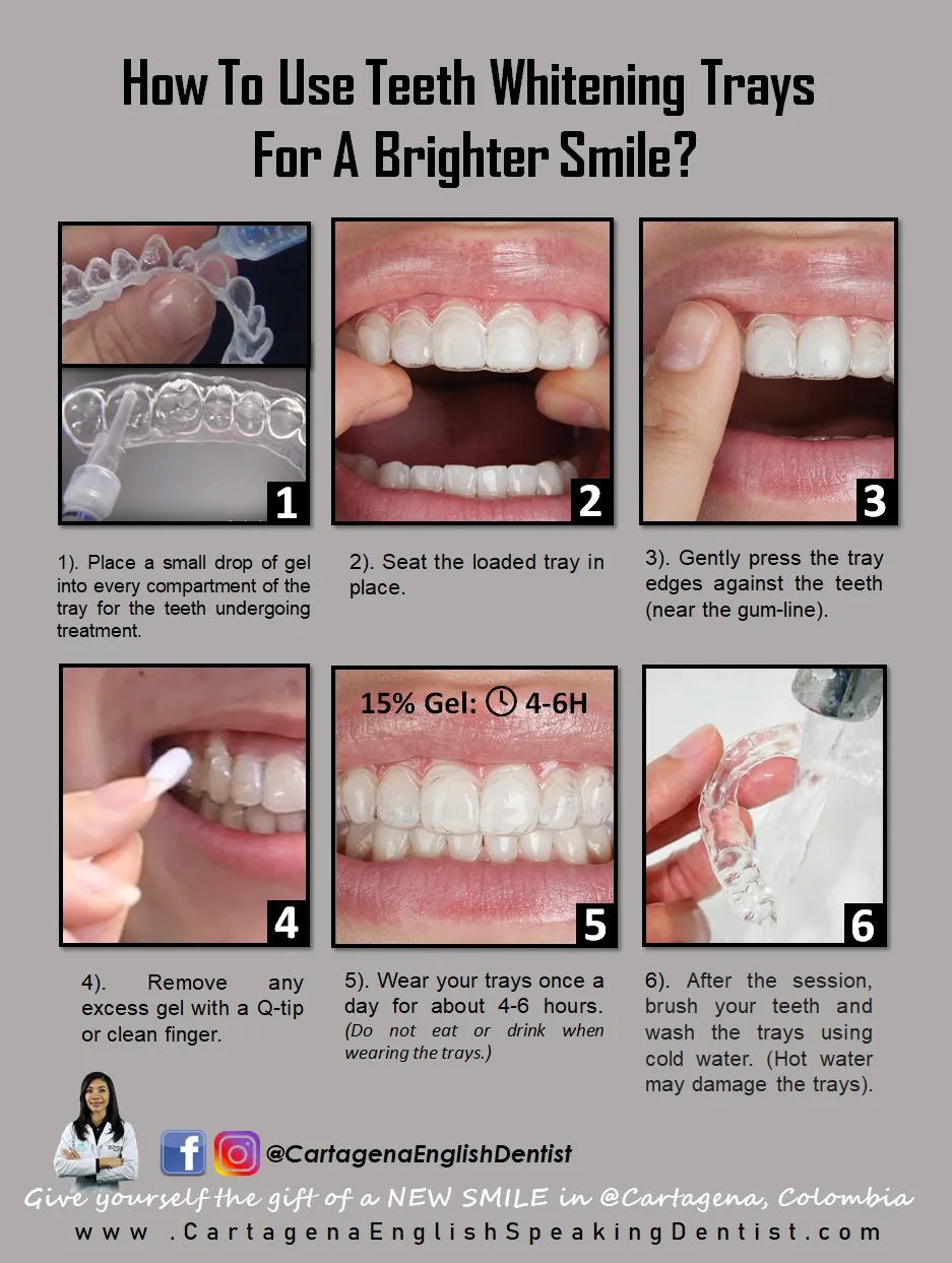 29174 sleeping with teeth whitening trays