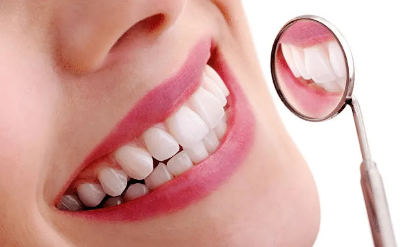 29175 oral hygiene maintenance