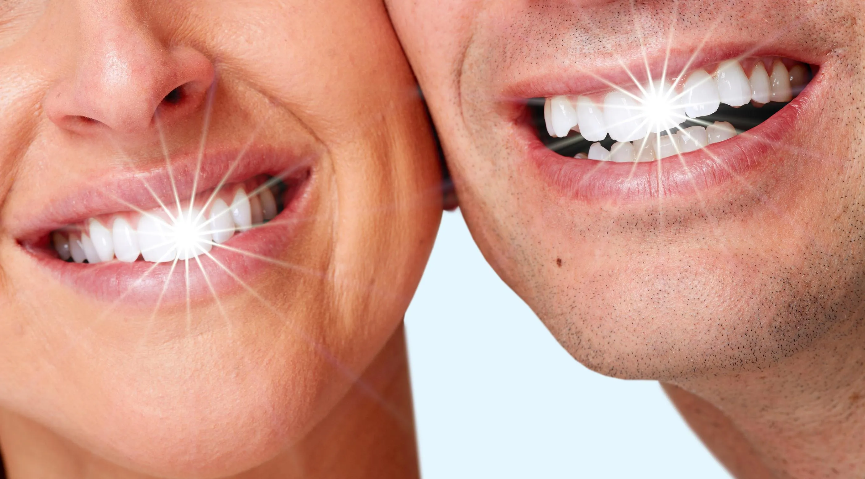 29175 professional teeth whitening