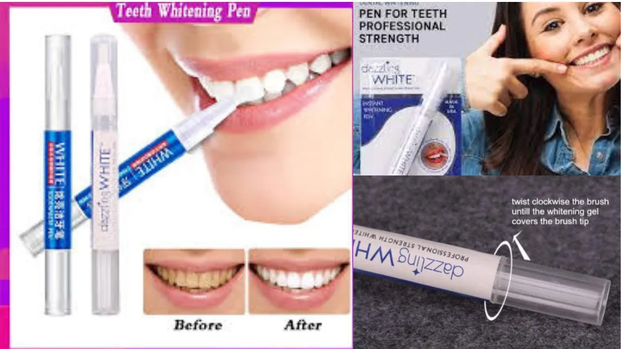 29179 teeth whitening comparison