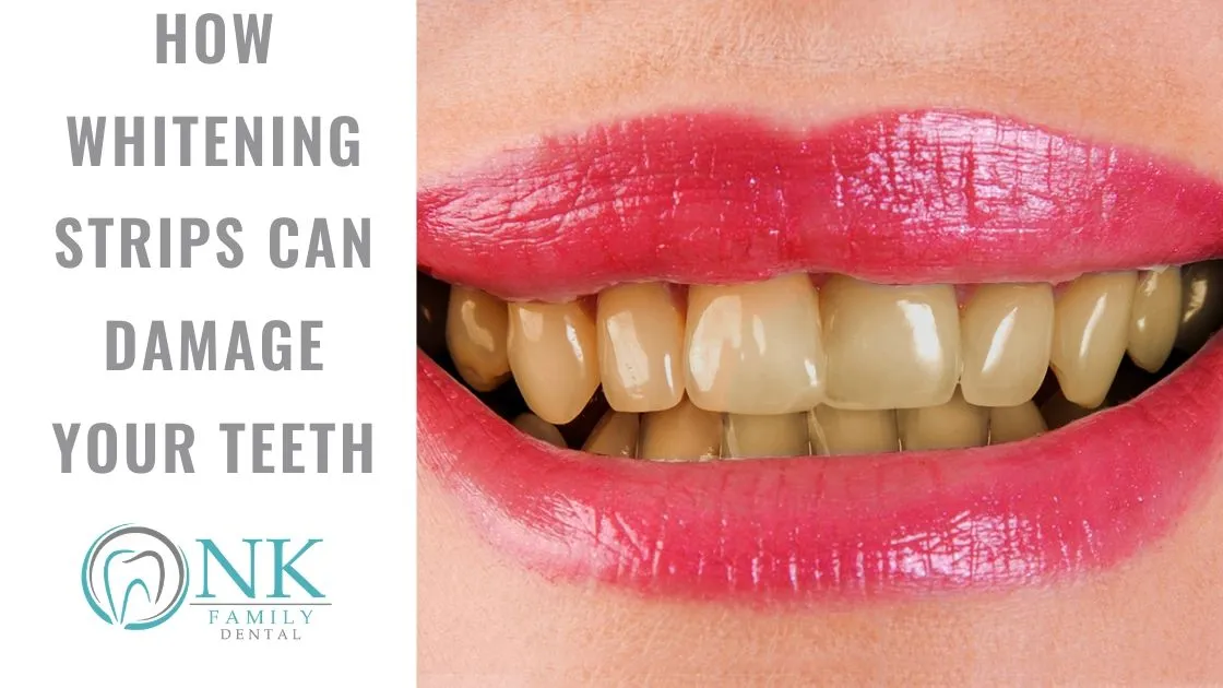 29182 hydrogen peroxide teeth whitening