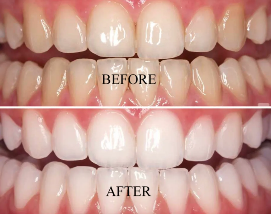 29182 professional dental advice