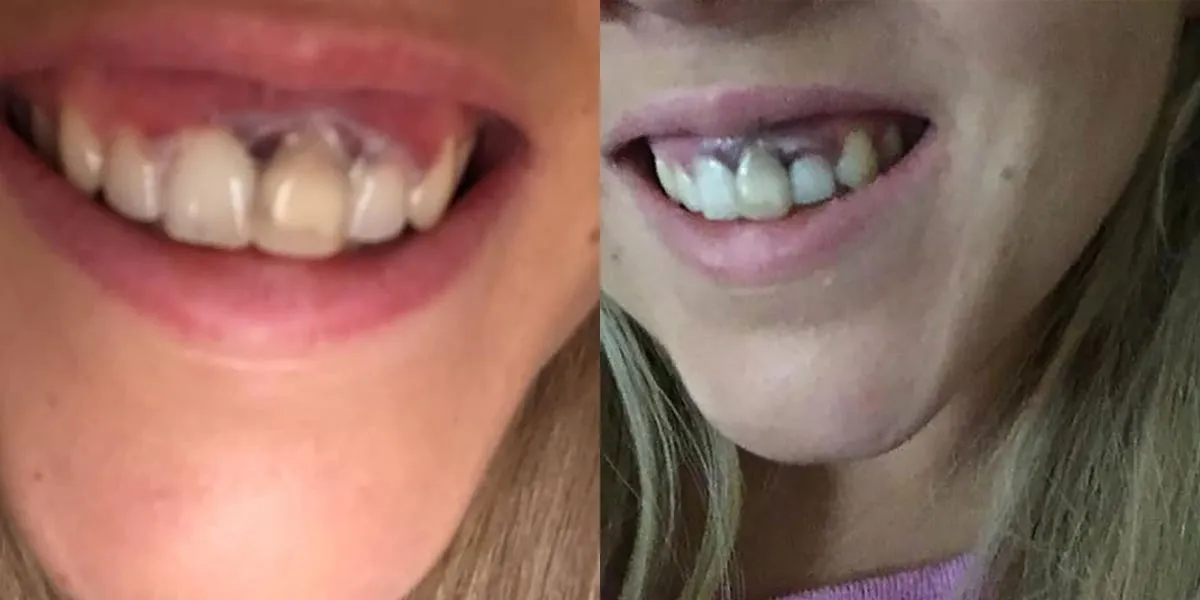 29182 whitening product selection