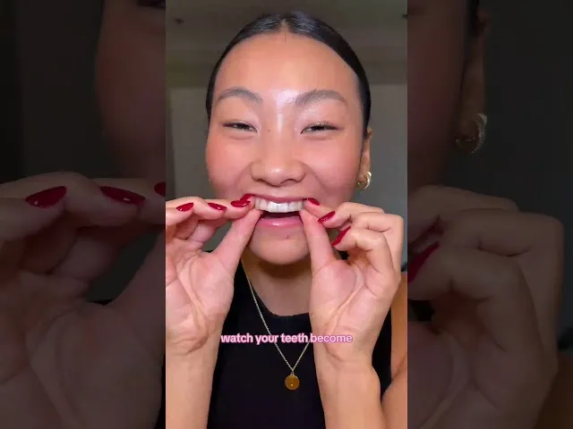 29184 procare whitening strips before after