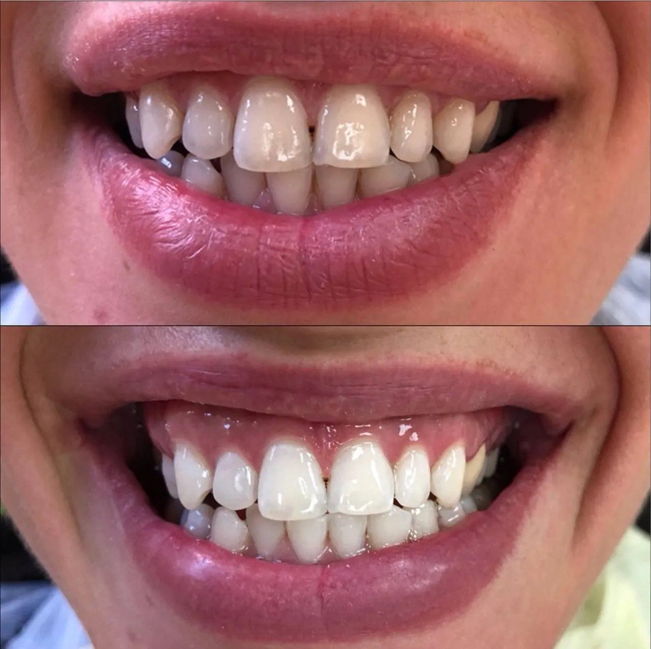/img/29189-dentist-consultation.webp