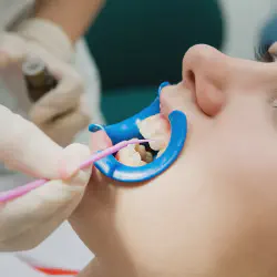 /img/29191-at-home-whitening.webp