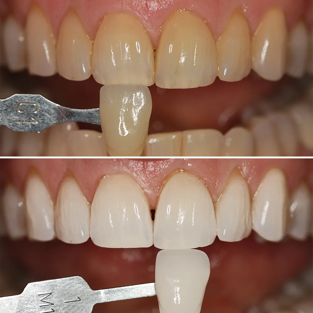 29191 healthy smile
