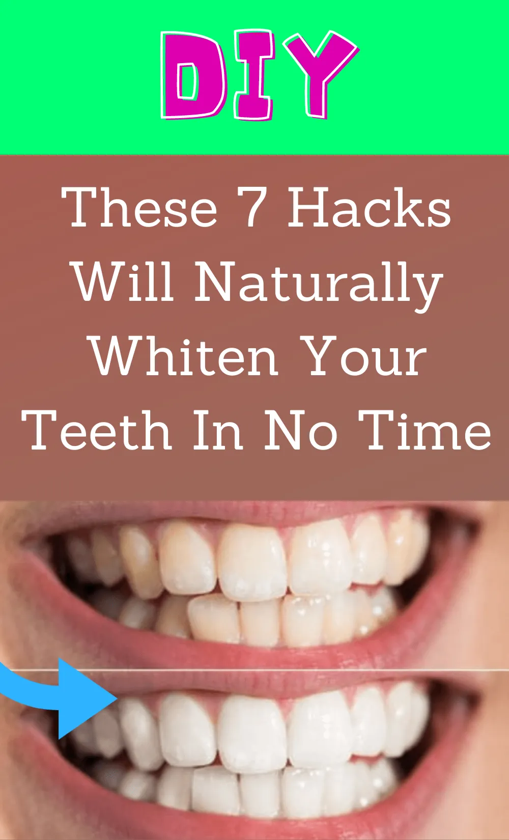29192 baking soda teeth