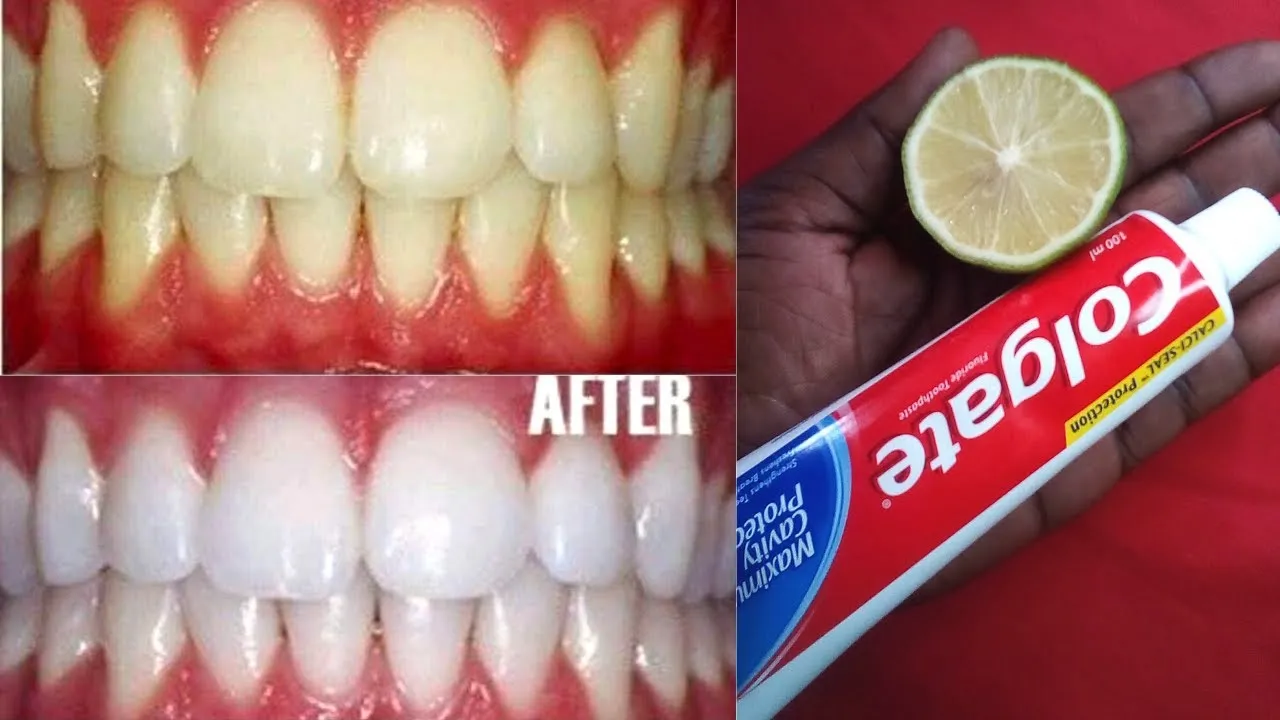 29192 coconut oil teeth
