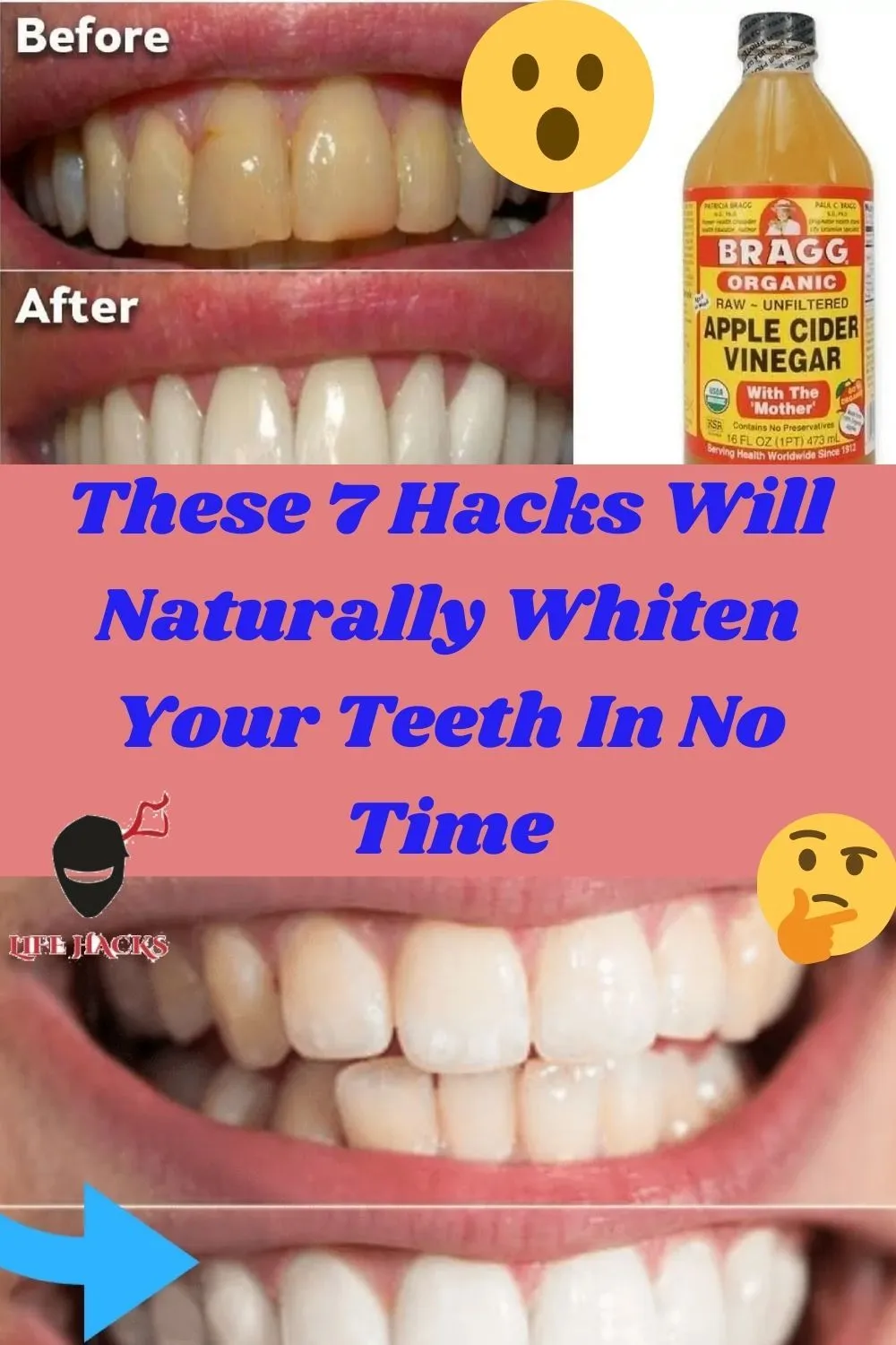 /img/29192-teeth-whitening-professional.webp