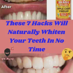 /img/29192-teeth-whitening-professional.webp
