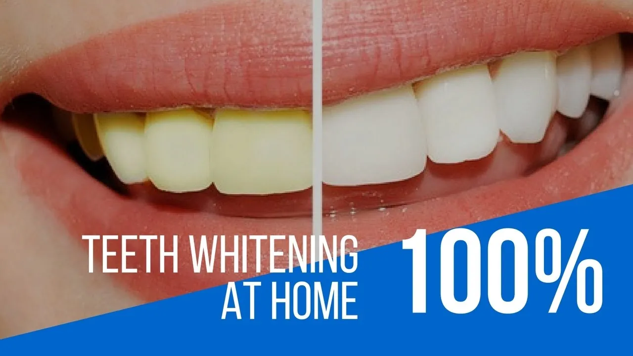 29192 whitening toothpaste