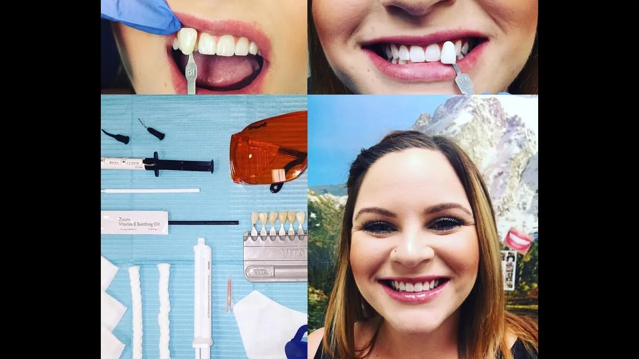 29197 teeth whitening henderson nv oral health