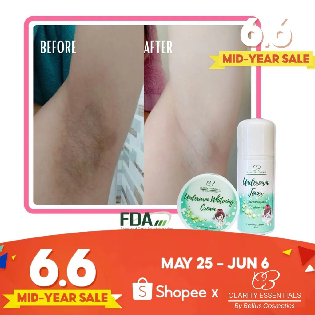 29199 underarm whitening cebu chemical peel