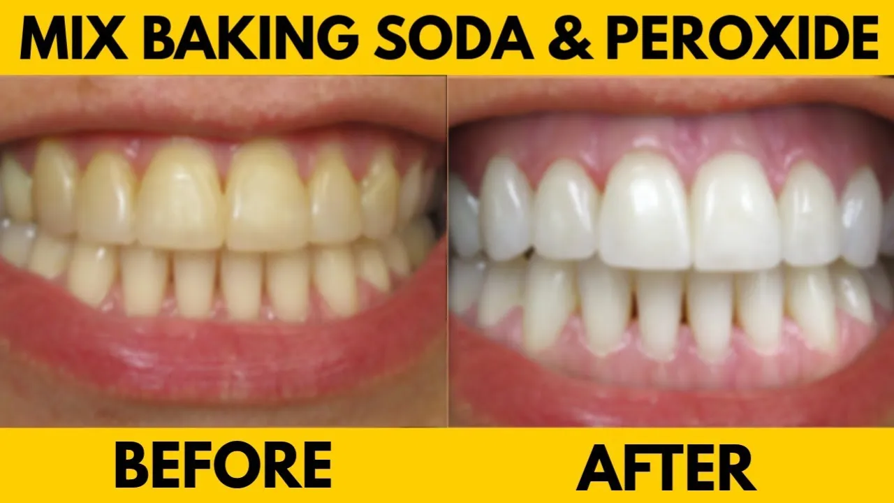 29202 baking soda mixture