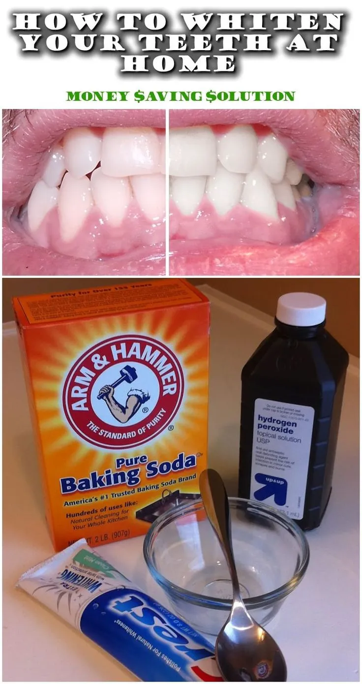 29202 proper oral hygiene