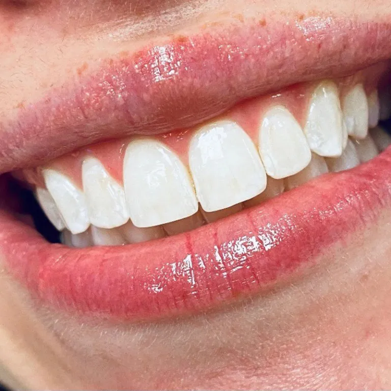/img/29207-healthy-smile.webp